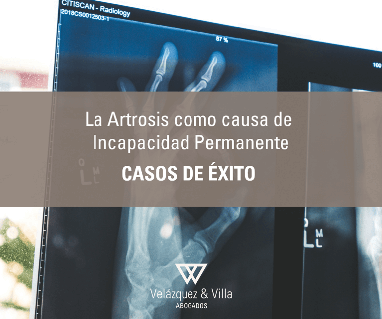 artrosis