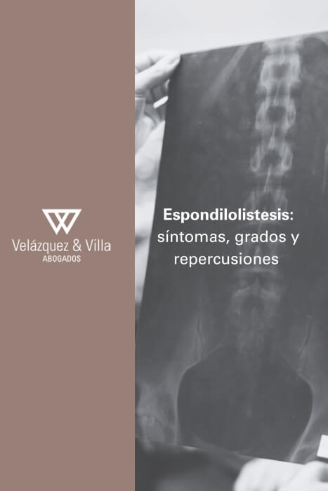Espondilolistesis enfermedad de incapacidad laboral, síntomas, grados y repercusiones