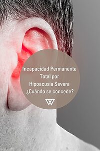 hombre con Incapacidad Permanente por Hipoacusia severa 