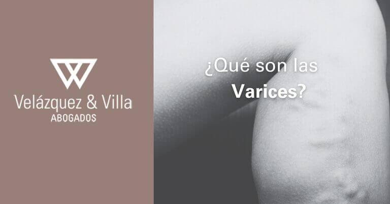 Qué son las Varices