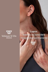 cuando se considera el lupus incapacidad permanente