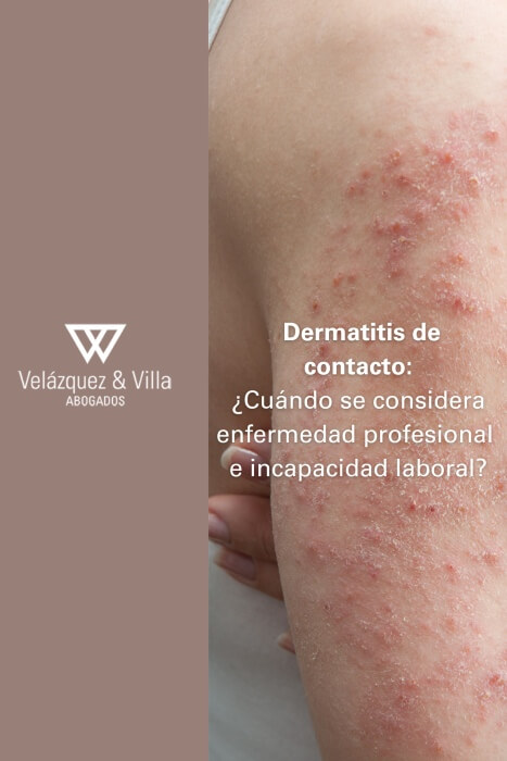 incapacidad permanente por Dermatitis de contacto